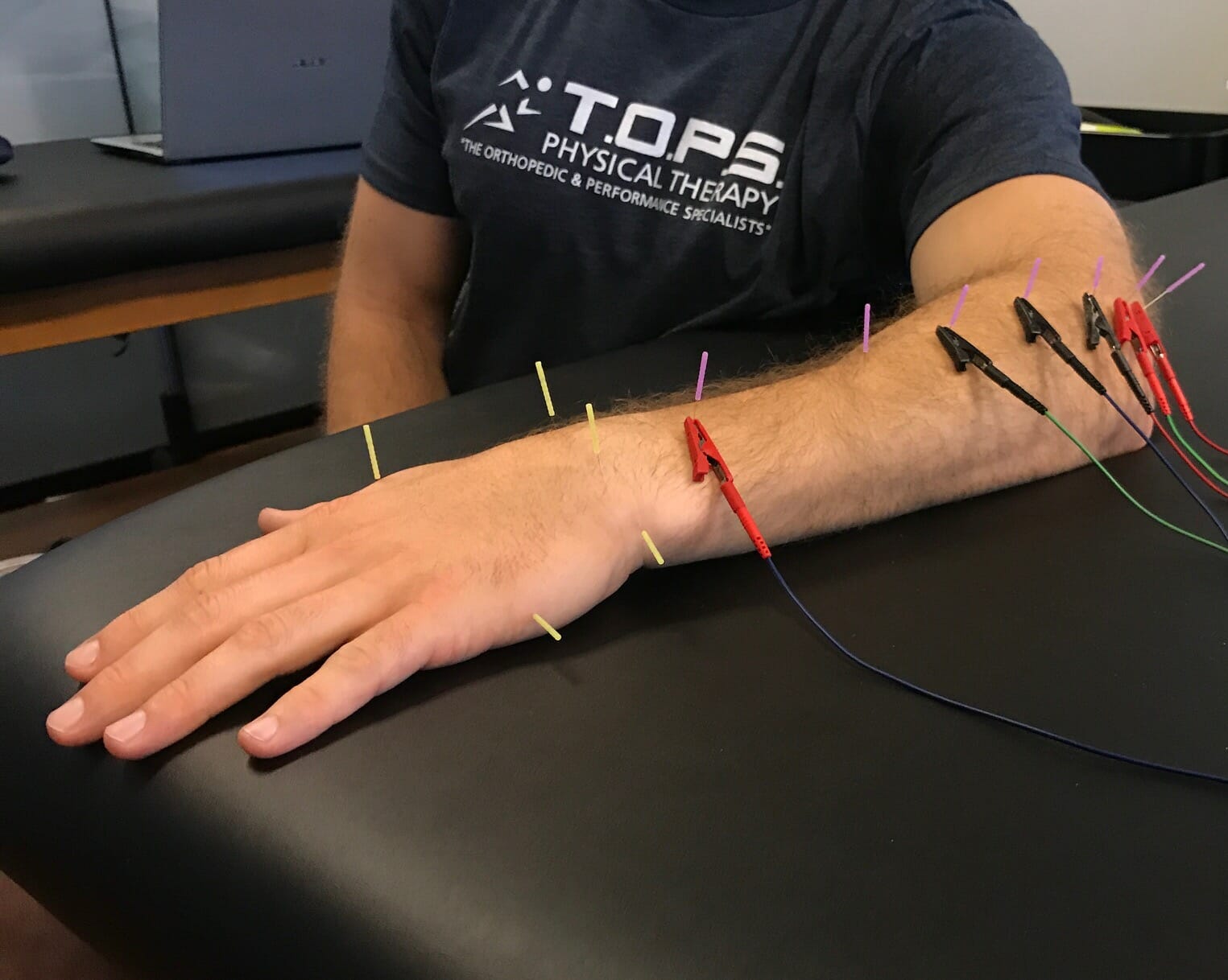 Physical Therapy Phoenix AZ